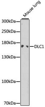 DLC1 Polyclonal Antibody