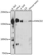 FANCD2 Antibody in Western Blot (WB)