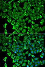 PSMD2 Polyclonal Antibody