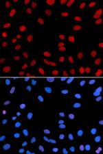IFI16 Antibody in Immunocytochemistry (ICC/IF)