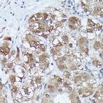 MT2A Polyclonal Antibody