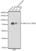SARS-CoV-2 NSP2 Polyclonal Antibody