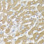 RSK1/RSK2/RSK3 Antibody in Immunohistochemistry (Paraffin) (IHC (P))
