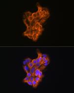 RAB11A/RAB11B Antibody in Immunocytochemistry (ICC/IF)