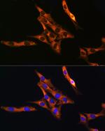 RAB11A/RAB11B Antibody in Immunocytochemistry (ICC/IF)