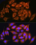 RAB11A/RAB11B Antibody in Immunocytochemistry (ICC/IF)