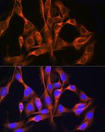 RAB11A/RAB11B Antibody in Immunocytochemistry (ICC/IF)