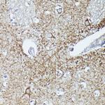 RAB11A/RAB11B Antibody in Immunohistochemistry (Paraffin) (IHC (P))