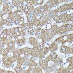 RAB11A/RAB11B Antibody in Immunohistochemistry (Paraffin) (IHC (P))
