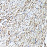 RAB11A/RAB11B Antibody in Immunohistochemistry (Paraffin) (IHC (P))