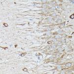 RAB11A/RAB11B Antibody in Immunohistochemistry (Paraffin) (IHC (P))