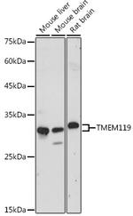 TMEM119 Polyclonal Antibody
