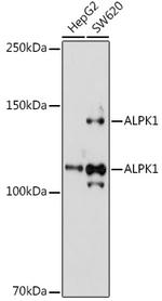 ALPK1 Polyclonal Antibody