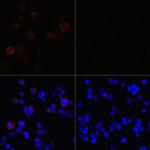 SARS-CoV-2 NSP13 Polyclonal Antibody