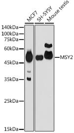YBX2 Polyclonal Antibody