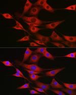 SSR2 Polyclonal Antibody