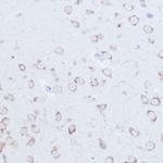 SSR2 Antibody in Immunohistochemistry (Paraffin) (IHC (P))