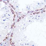 SSR2 Antibody in Immunohistochemistry (Paraffin) (IHC (P))