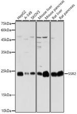 SSR2 Antibody in Western Blot (WB)