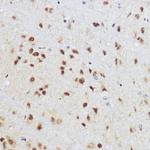 KLF12 Polyclonal Antibody