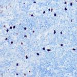 S100A8 Polyclonal Antibody
