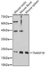 TM4SF19 Polyclonal Antibody