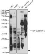 Succinylated Lysine Polyclonal Antibody