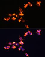 PSA Polyclonal Antibody