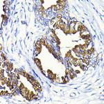 PSA Antibody in Immunohistochemistry (Paraffin) (IHC (P))