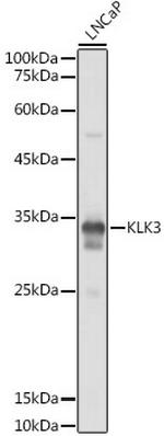 PSA Antibody in Western Blot (WB)