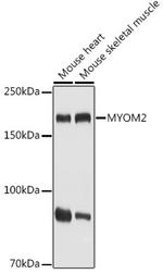 MYOM2 Antibody in Western Blot (WB)