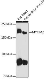MYOM2 Polyclonal Antibody