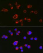 HTR2A Polyclonal Antibody