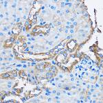CAPZA2 Antibody in Immunohistochemistry (Paraffin) (IHC (P))