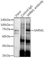 SARM Antibody in Immunoprecipitation (IP)