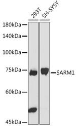 SARM Polyclonal Antibody