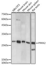 PRRX2 Antibody in Western Blot (WB)
