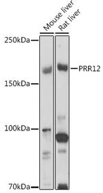 PRR12 Polyclonal Antibody