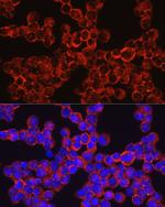 CD33 Antibody in Immunocytochemistry (ICC/IF)