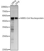 MERS Coronavirus NP Polyclonal Antibody