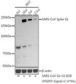 SARS-CoV Spike Protein S1 Polyclonal Antibody