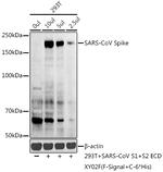 SARS Coronavirus Spike Protein Polyclonal Antibody