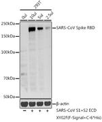 SARS-CoV Spike Protein RBD Polyclonal Antibody