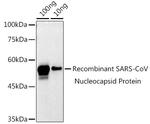 SARS-CoV-2 Nucleocapsid Antibody in Western Blot (WB)