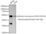 HCoV-OC43 Nucleoprotein Polyclonal Antibody
