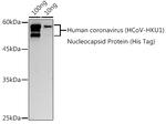 HCoV-HKU1 Nucleoprotein Polyclonal Antibody