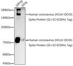HCoV-OC43 Spike S2 Antibody in Western Blot (WB)