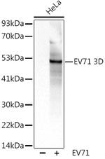 Enterovirus 71 3D Antibody in Western Blot (WB)