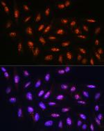 FANCD2 Polyclonal Antibody