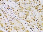 IKK beta Polyclonal Antibody